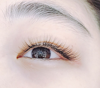 서브 이미지