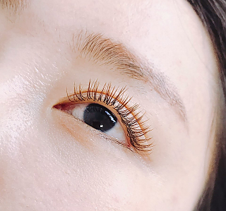 서브 이미지
